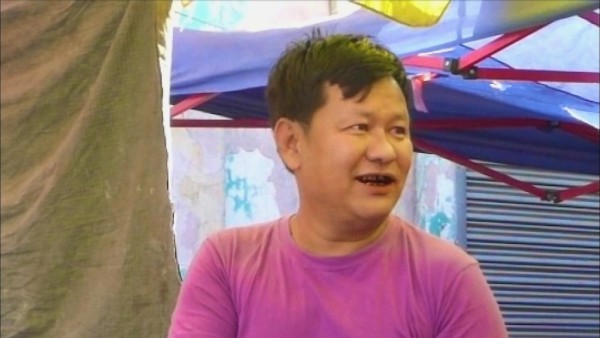 Burmese man's teeth Burmese man's teeth